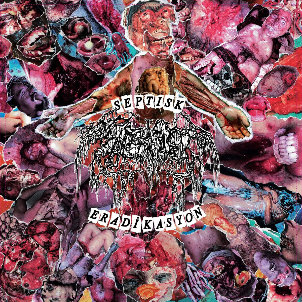 Septage – Septisk eradikasyon vinyl cover