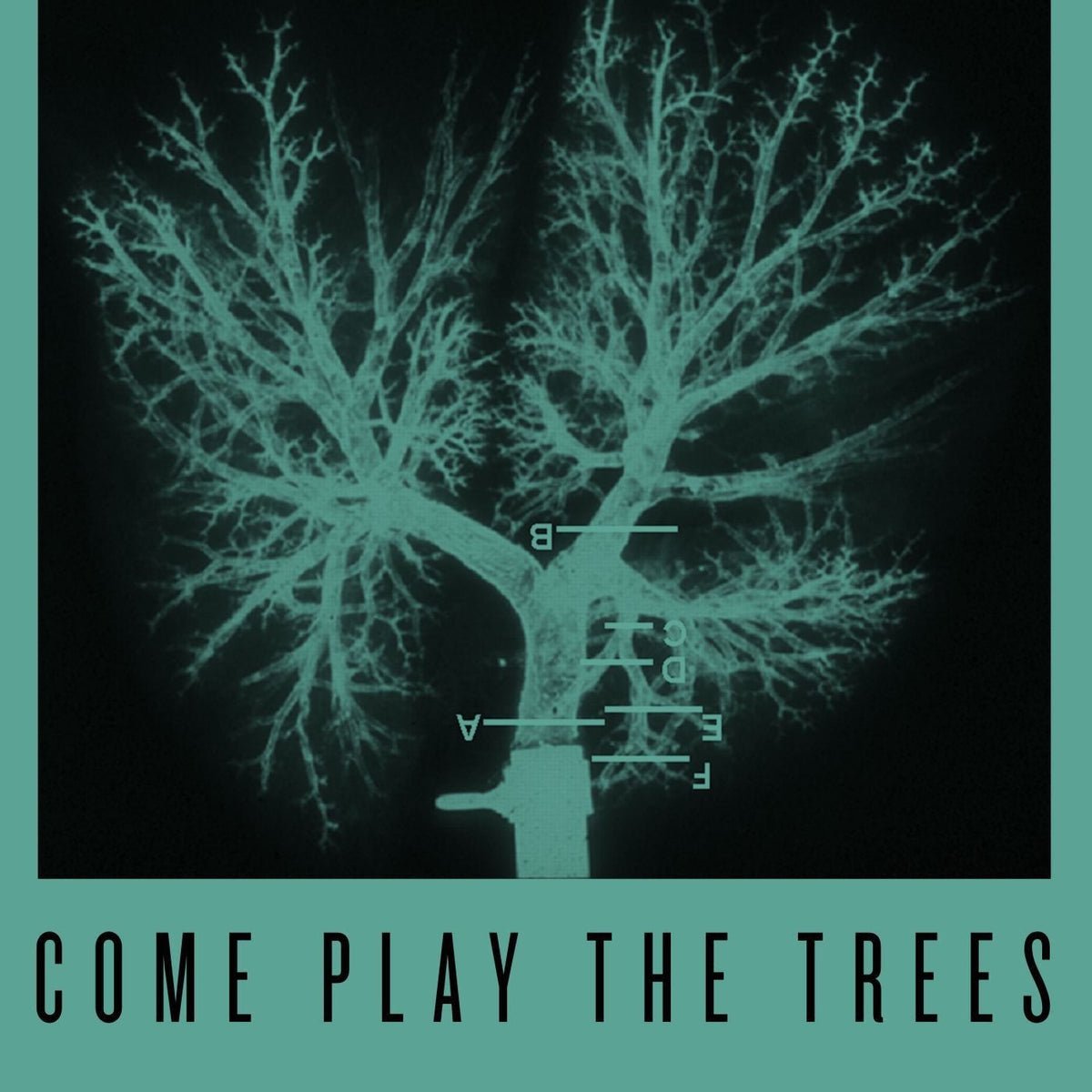 Snapped Ankles – Come Play the Trees vinyl record cover