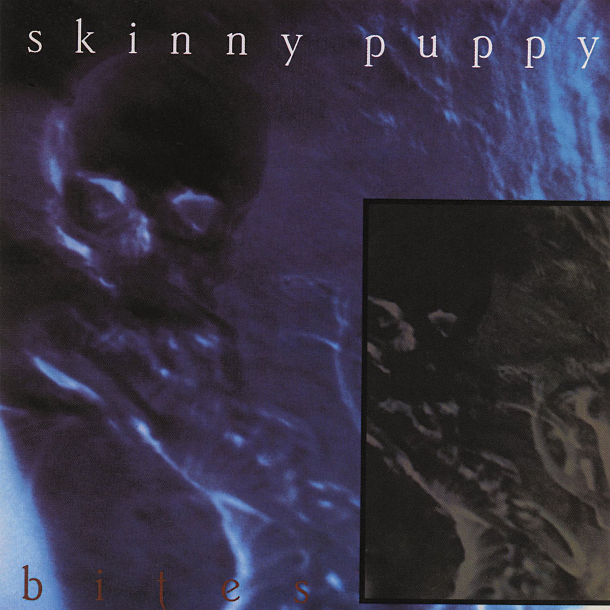 Skinny Puppy – Bites vinyl record cover